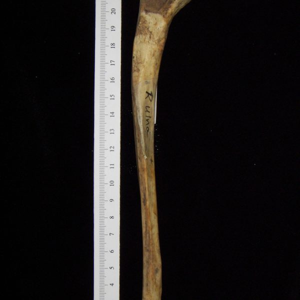 human-homo-sapiens-right-ulna-anterior-ccco