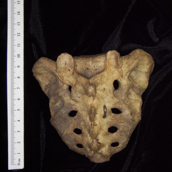 human-homo-sapiens-sacrum-posterior-ccco