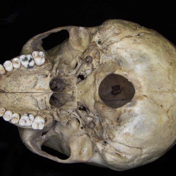 human-homo-sapiens-cranium-inferior-ccco