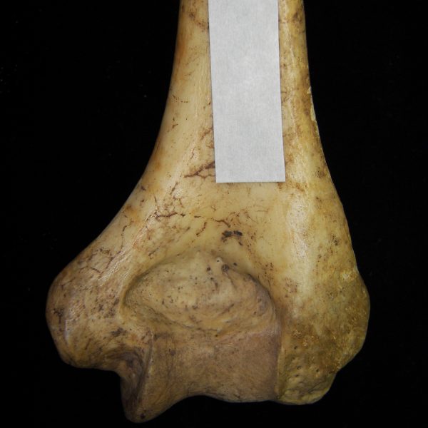 human-homo-sapiens-right-humerus-distal-posterior-aspect-ccco