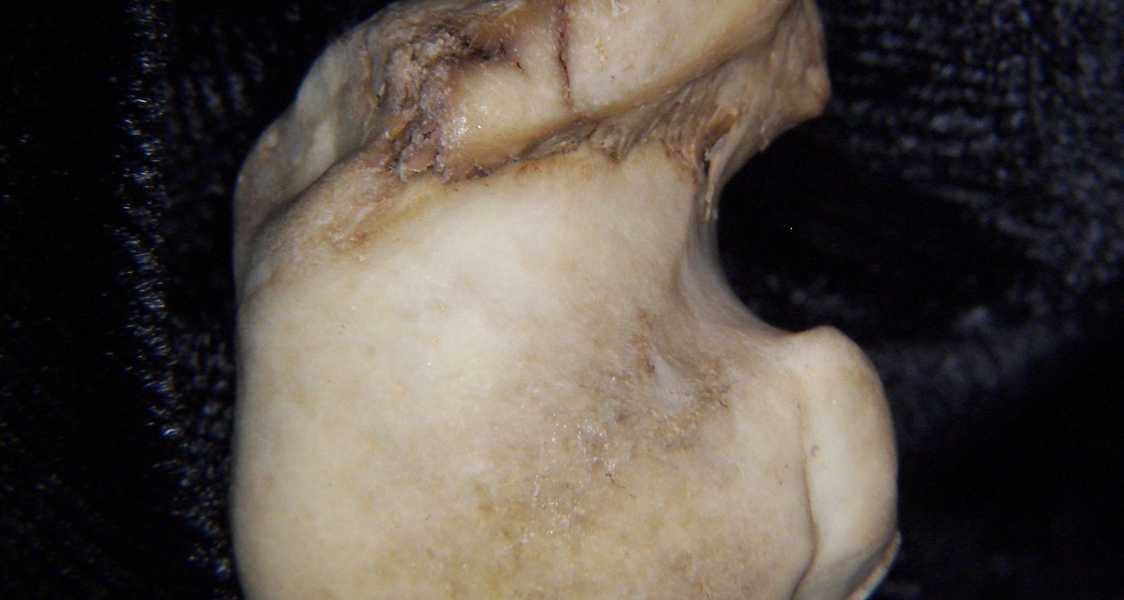 Bobcat (Lynx rufus) left humerus, superior view of head