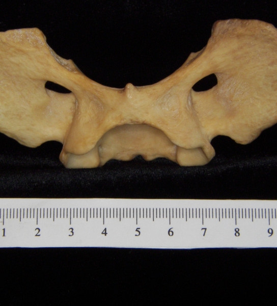 Dog (Canis lupus familiaris) C1 (1st cervical vertebra), inferior view