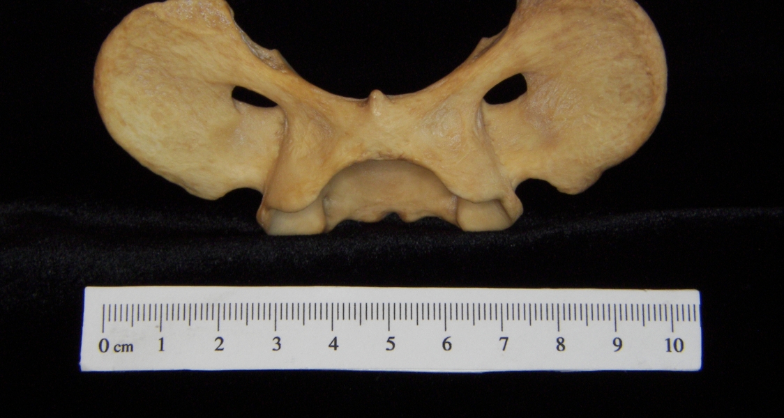 Dog (Canis lupus familiaris) C1 (1st cervical vertebra), inferior view