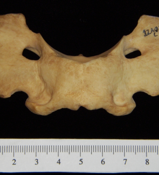 Dog (Canis lupus familiaris) C1 (1st cervical vertebra), superior view