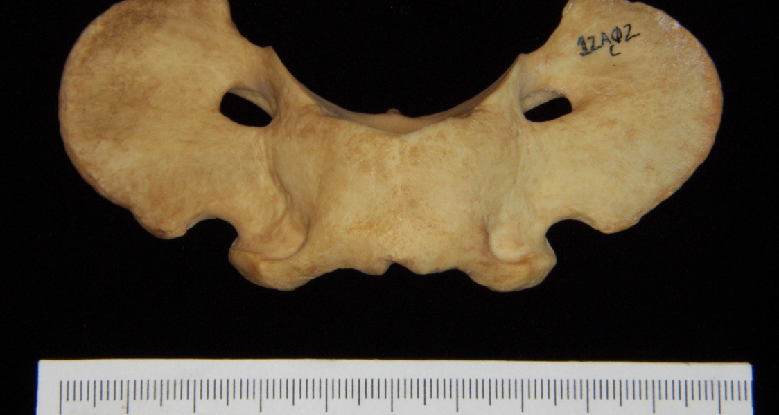 Dog (Canis lupus familiaris) C1 (1st cervical vertebra), superior view