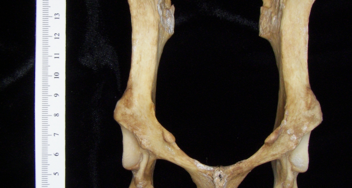 Dog (Canis lupus familiaris) pelvis