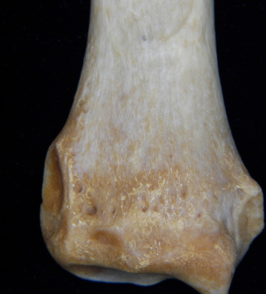 Dog (Canis lupus familiaris) left radius, distal aspect, view 2