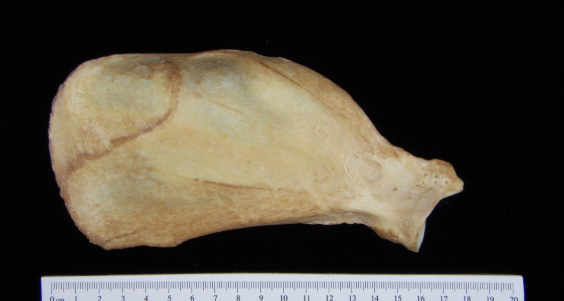 Dog (Canis lupus familiaris) left scapula, anterior view