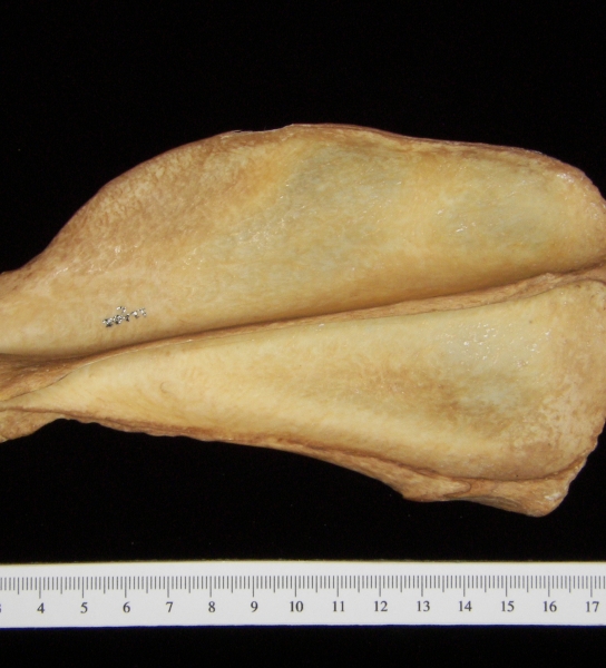 Dog (Canis lupus familiaris) left scapula, posterior view