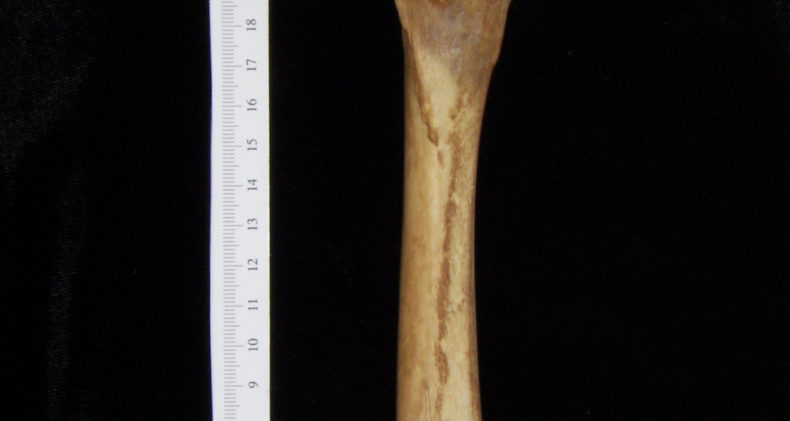 Dog (Canis lupus familiaris) right femur, posterior view