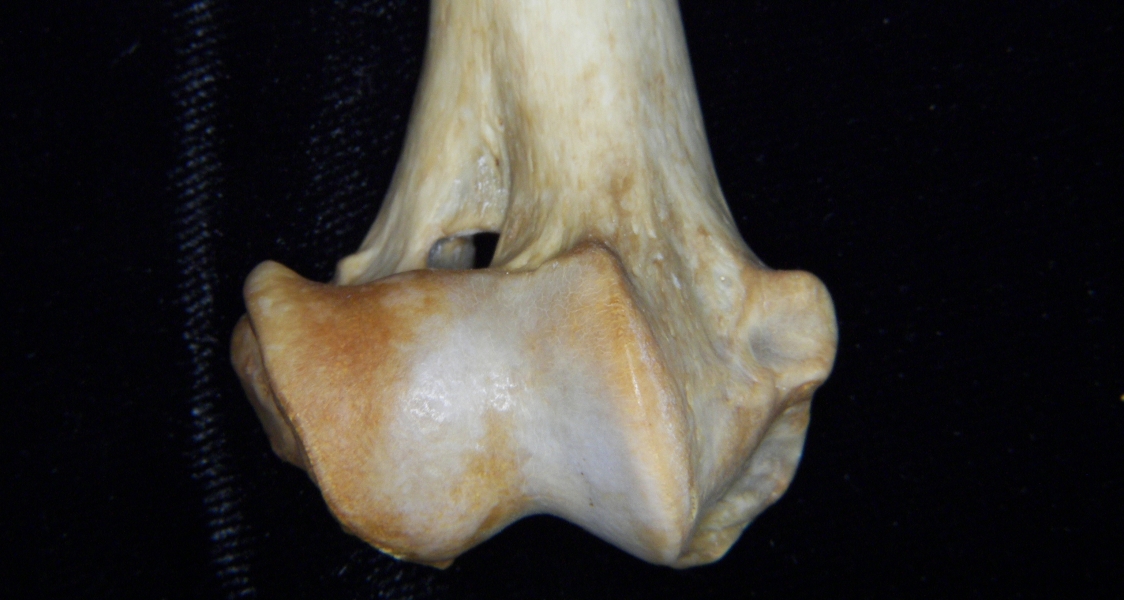 Dog (Canis lupus familiaris) right humerus, distal aspect