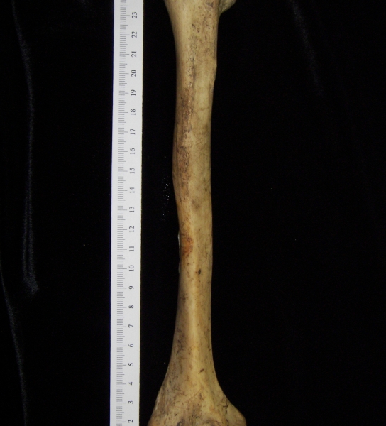 Human right humerus, lateral view