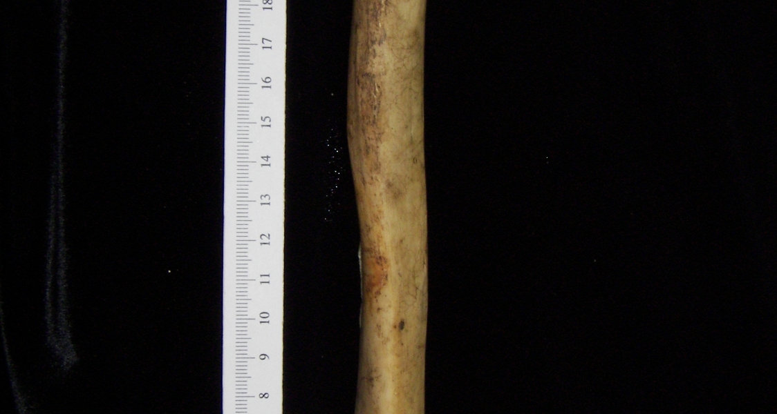 Human right humerus, lateral view