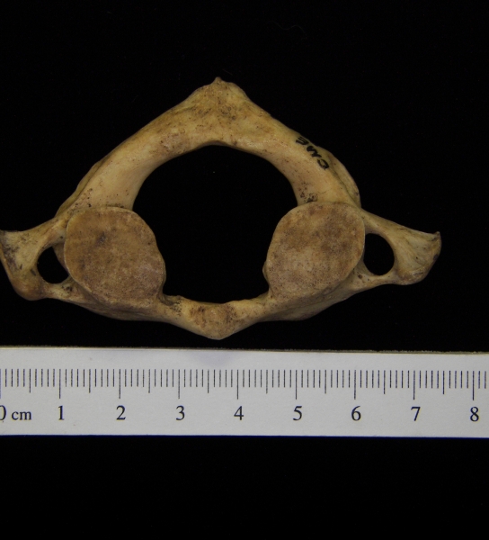 Human C1 (1st cervical vertebra), inferior view