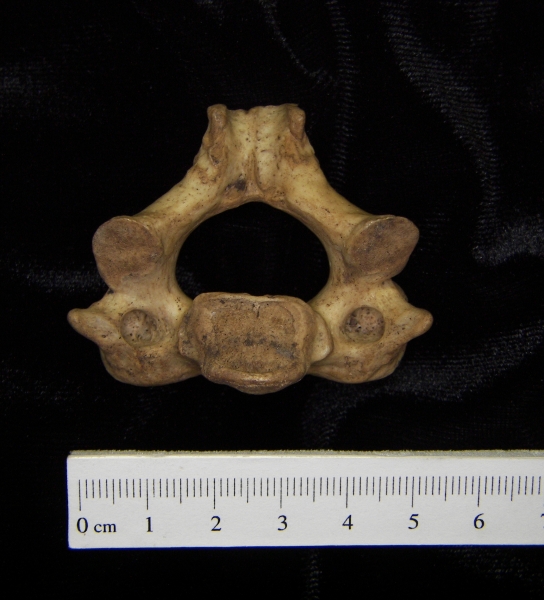 Human C2 (2nd cervical vertebra), inferior view