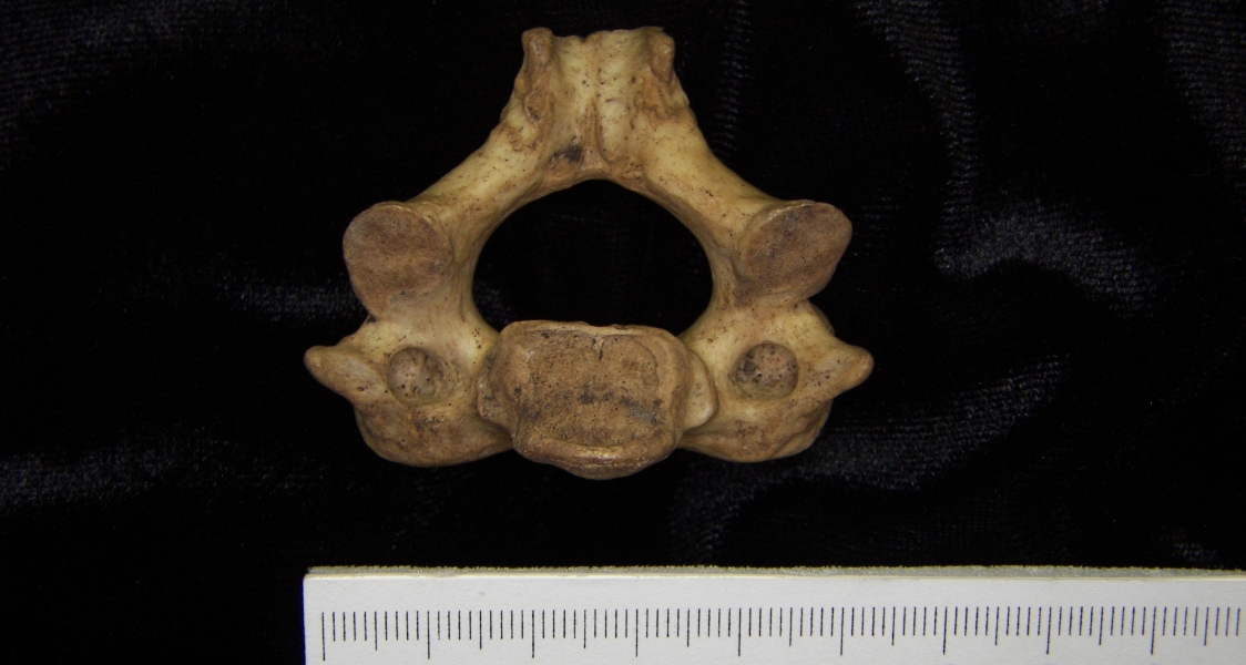 Human C2 (2nd cervical vertebra), inferior view