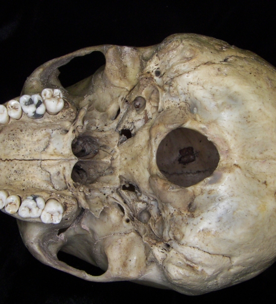 Human cranium, inferior view
