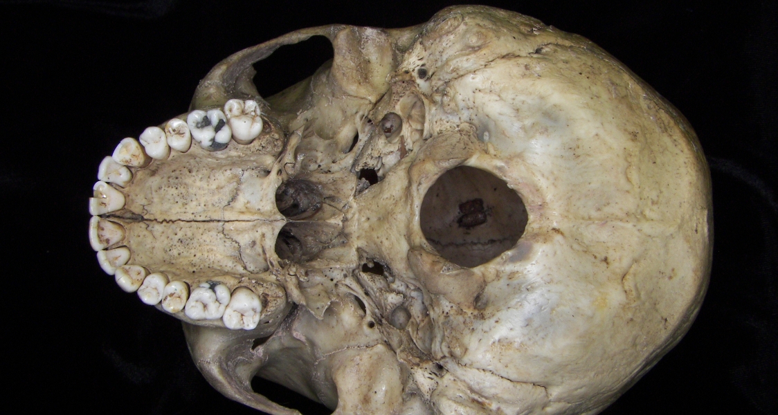 Human cranium, inferior view