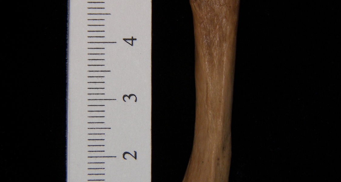 Human left 3rd metacarpal, dorsal view