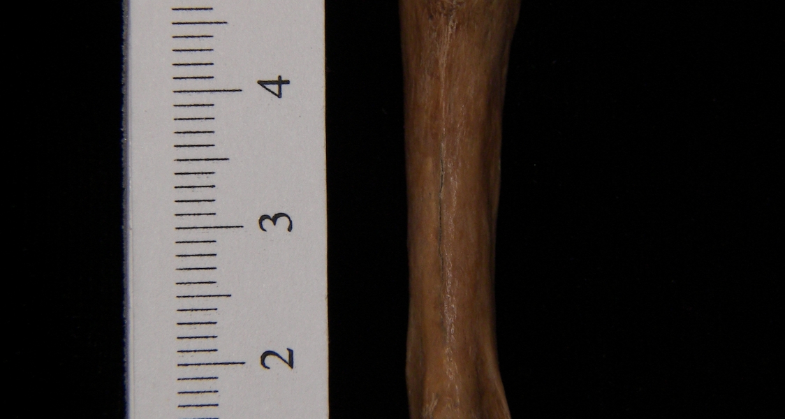 Human left 3rd metacarpal