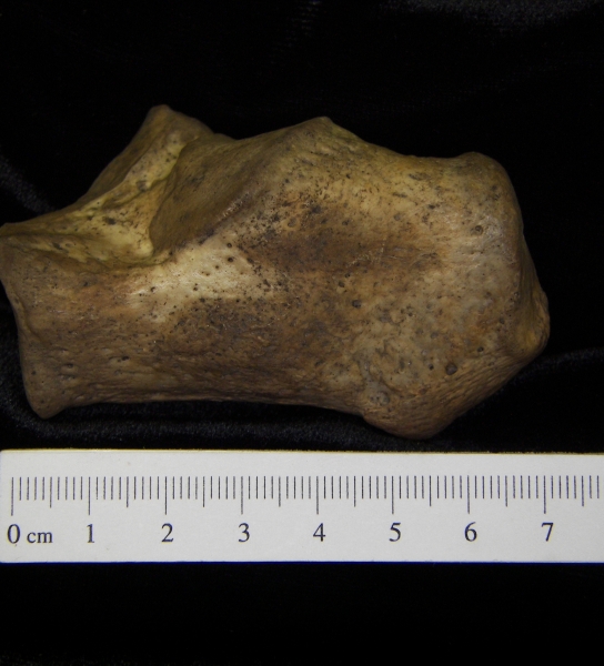 lateral View Left Human Calcaneus