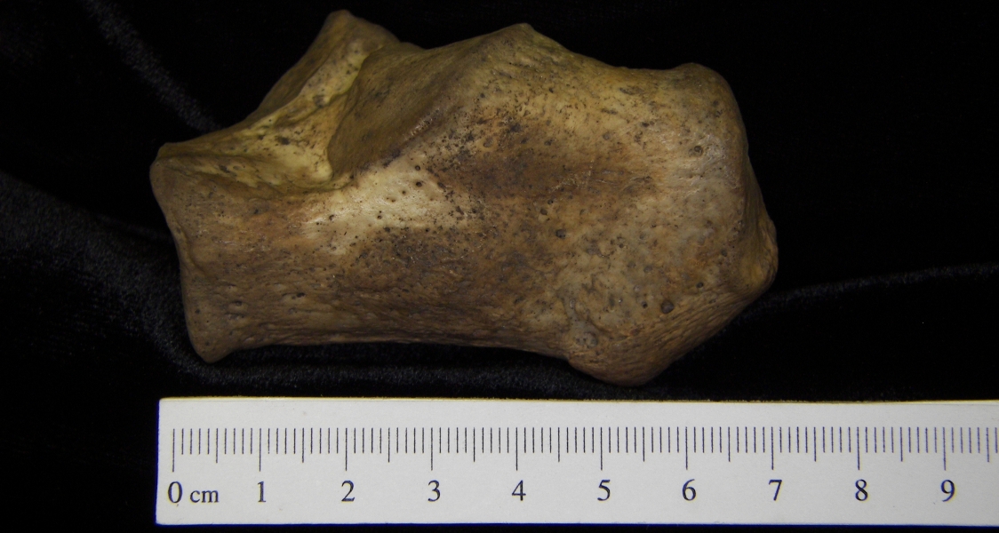 lateral View Left Human Calcaneus