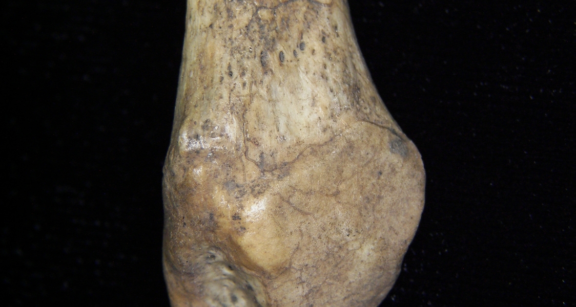 Human left fibula, distal aspect