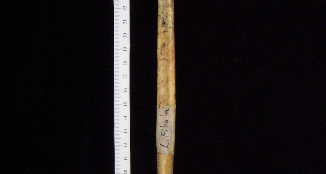 Human left fibula, lateral view