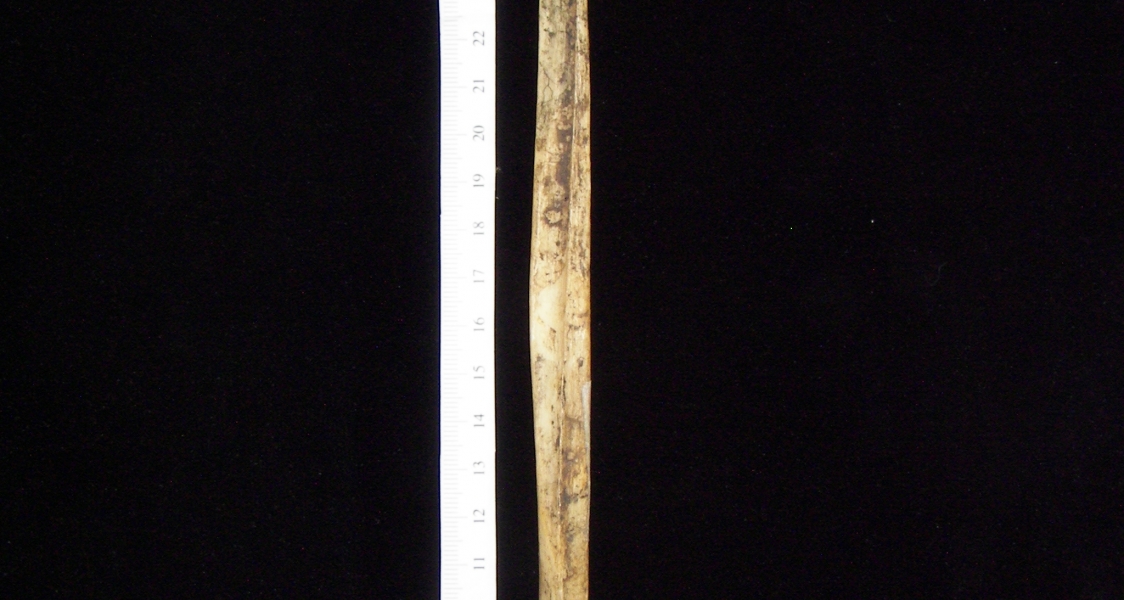 Human left fibula, medial view