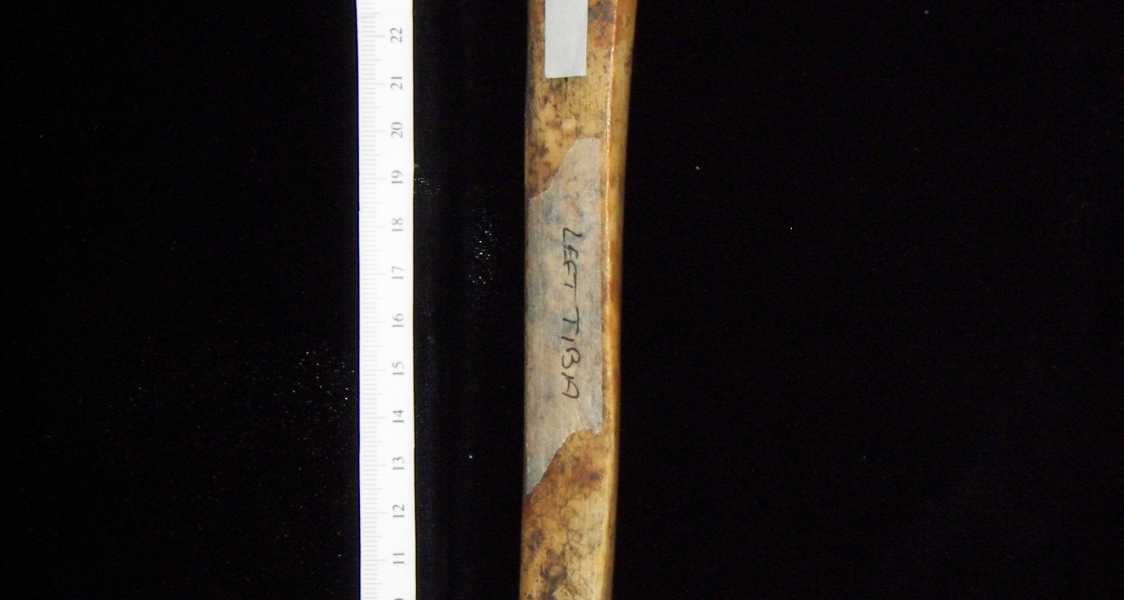 Human left tibia, anterior view