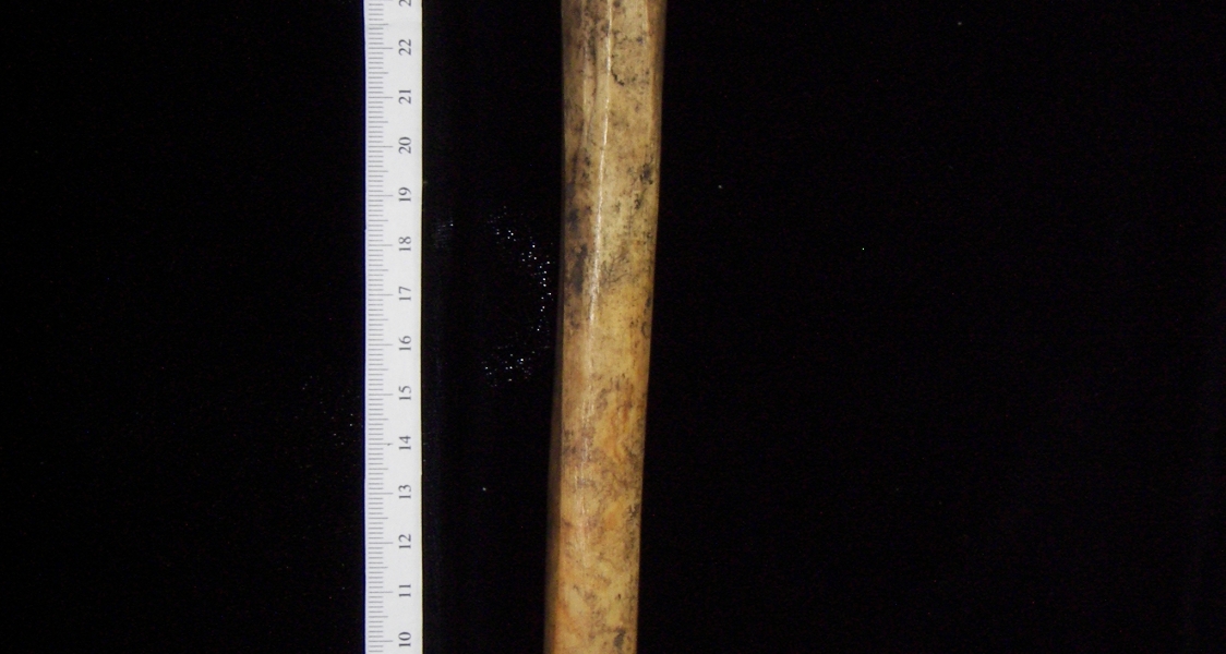 Human left tibia, posterior view