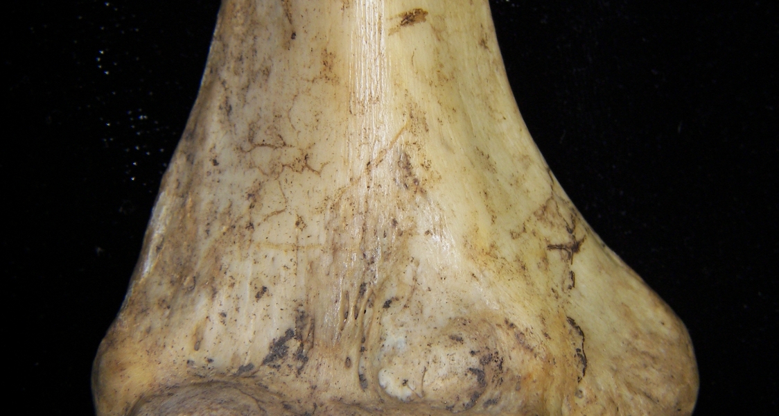 Human right humerus, distal aspect, view 2