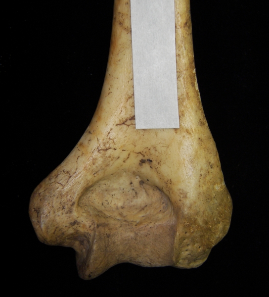 Human right humerus, distal aspect