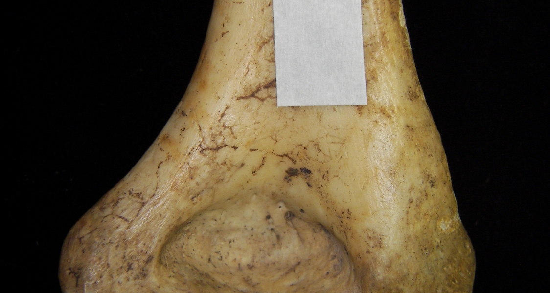 Human right humerus, distal aspect