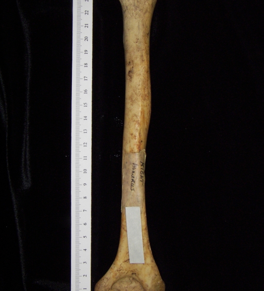 Human right humerus, posterior view