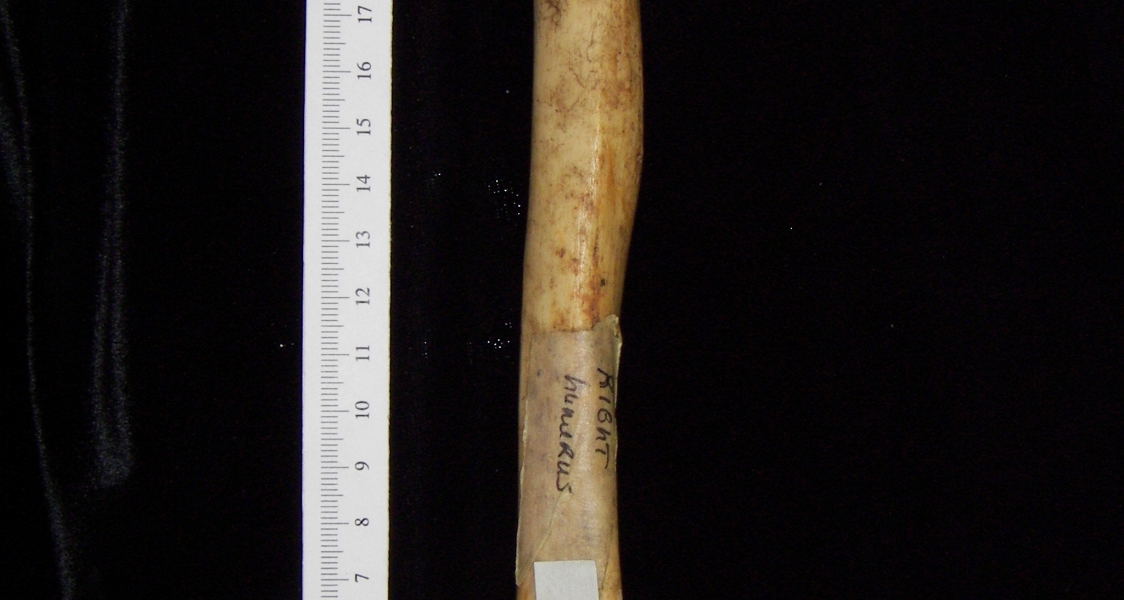 Human right humerus, posterior view