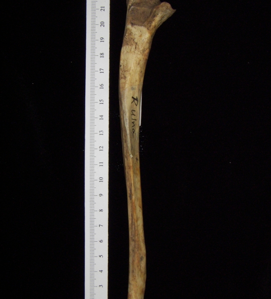 Anterior View Right Human Ulna