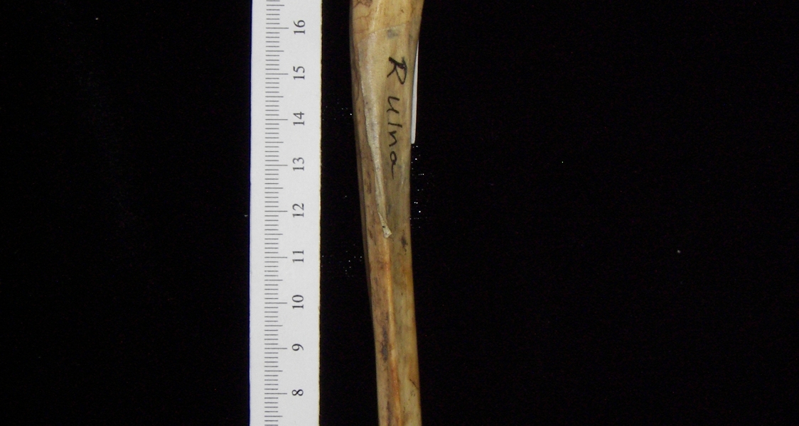 Anterior View Right Human Ulna