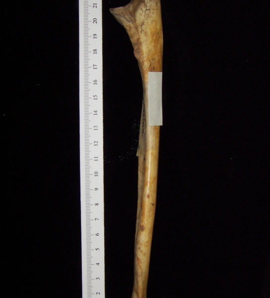 Lateral View Right Human Ulna