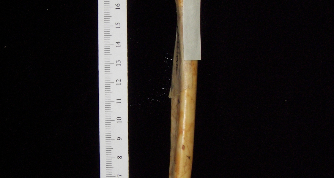 Lateral View Right Human Ulna