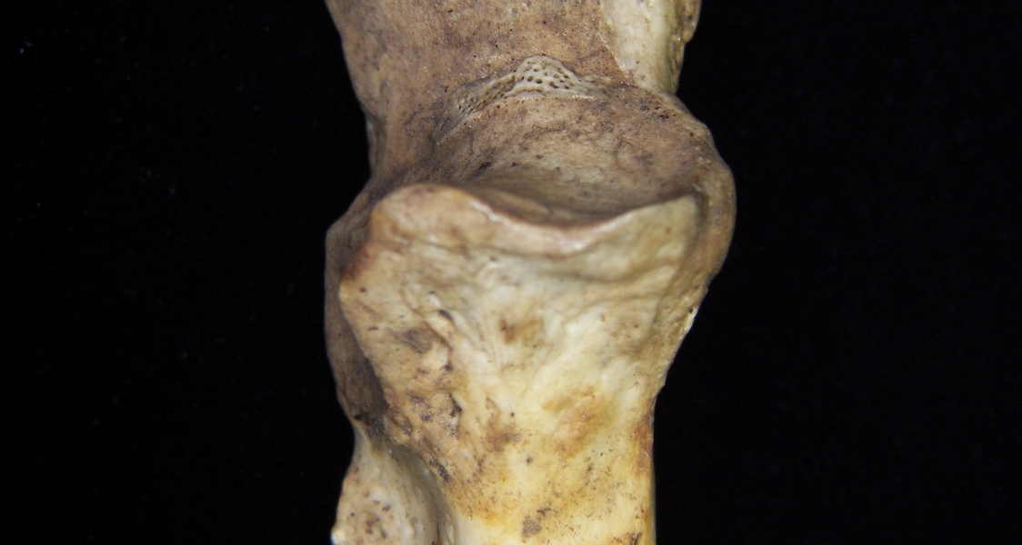 Proximal View Artic. Surface Right Human Ulna