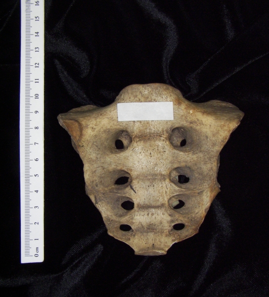 Anterior View Human Sacrum