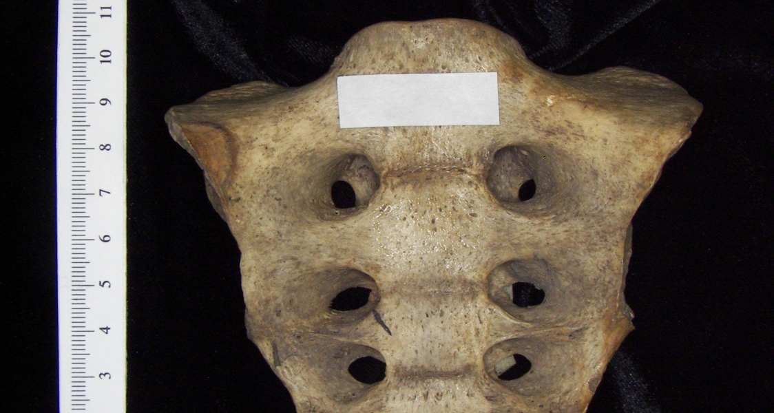 Anterior View Human Sacrum