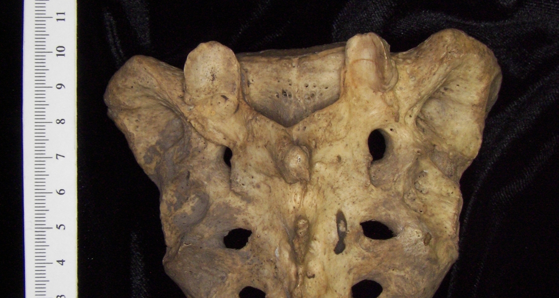 Posterior View Human Sacrum