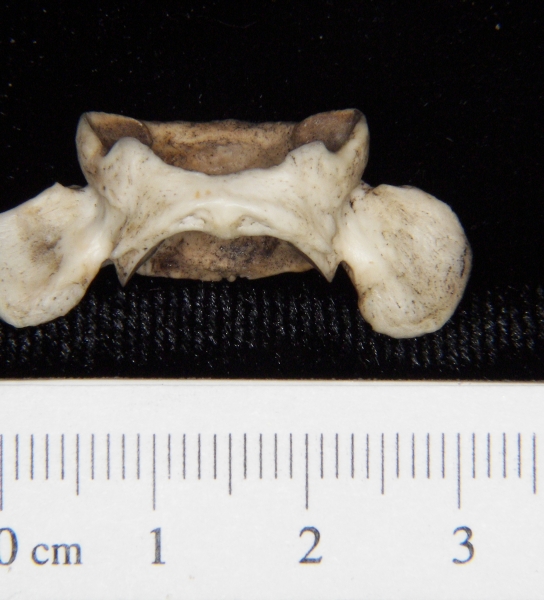 Opossum (Didelphis marsupialis) C1, inferior view