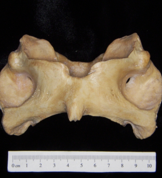 Pig (Sus scrofa) 1st cervical vertebra, inferior view