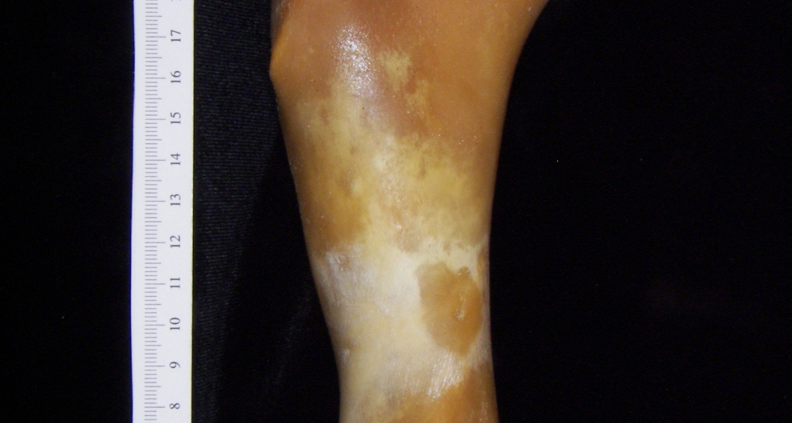 Pig (Sus scrofa) humerus, view 2