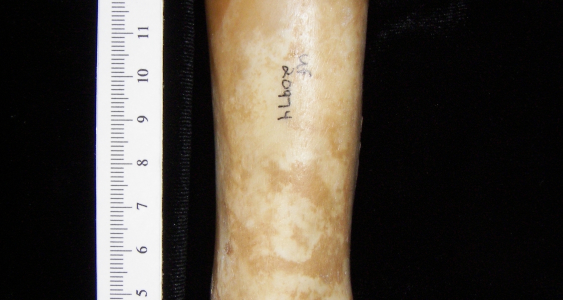 Pig (Sus scrofa) radius, anterior view