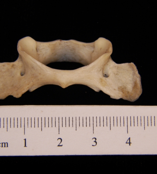 Raccoon (Procyon lotor) C2, inferior view