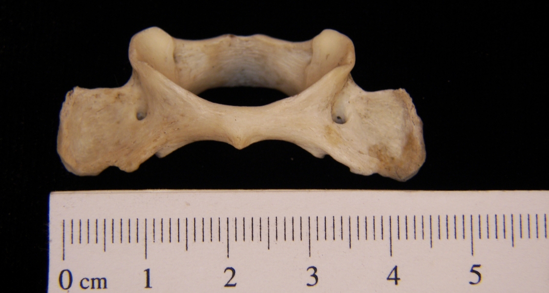 Raccoon (Procyon lotor) C2, inferior view